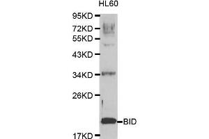 Image no. 1 for anti-BH3 Interacting Domain Death Agonist (BID) antibody (ABIN3020688)