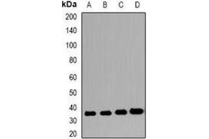 Image no. 1 for anti-V-Set and Immunoglobulin Domain Containing 2 (VSIG2) antibody (ABIN3223021)