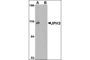 Image no. 2 for anti-Junctophilin 3 (JPH3) (Center) antibody (ABIN500102)