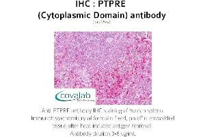 Image no. 2 for anti-Protein tyrosine Phosphatase, Receptor Type, E (PTPRE) (Cytoplasmic Domain) antibody (ABIN1738605)