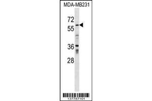 Image no. 1 for anti-Zinc Finger Protein 543 (ZNF543) (AA 40-67), (N-Term) antibody (ABIN1539343)