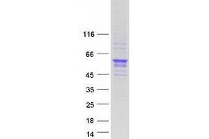 Image no. 1 for Olfactomedin-Like 3 (OLFML3) protein (Myc-DYKDDDDK Tag) (ABIN2727898)