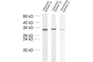 Image no. 2 for anti-Syntaxin 1B (STX1B) (AA 171-187) antibody (ABIN1742218)