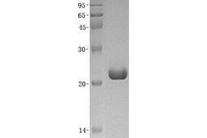 Image no. 1 for SUMO/sentrin Specific Peptidase Family Member 8 (SENP8) (Transcript Variant 1) protein (His tag) (ABIN2731655)