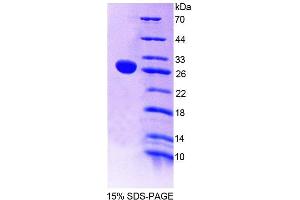 Image no. 1 for 5'-Nucleotidase, Cytosolic II (NT5C2) (AA 1-212) protein (His tag) (ABIN6239519)