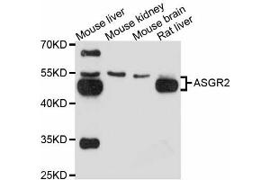 Image no. 1 for anti-Asialoglycoprotein Receptor 2 (ASGR2) antibody (ABIN4902953)