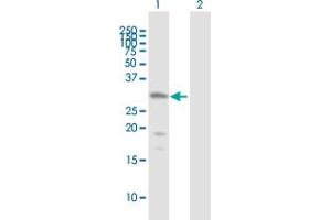 Image no. 2 for anti-Histone Deacetylase 7 (HDAC7) (AA 1-276) antibody (ABIN526813)