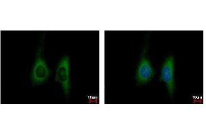 Image no. 2 for anti-Killer Cell Immunoglobulin-Like Receptor, Two Domains, Long Cytoplasmic Tail, 4 (KIR2DL4) (Center) antibody (ABIN2856036)