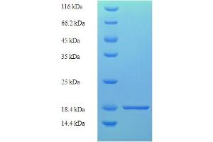 Tight Junction Protein 1 (TJP1) (AA 1633-1769), (partial) protein (His tag)