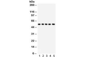 Image no. 3 for anti-Abl-Interactor 1 (ABI1) antibody (ABIN4952702)
