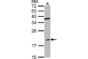 Image no. 2 for anti-Interferon, alpha 8 (IFNA8) (Center) antibody (ABIN2856157)