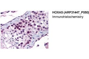 Image no. 2 for anti-Homeobox A5 (HOXA5) (Middle Region) antibody (ABIN2777305)