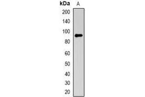 Image no. 2 for anti-Melanoma Antigen Family D, 1 (MAGED1) (full length) antibody (ABIN6043650)