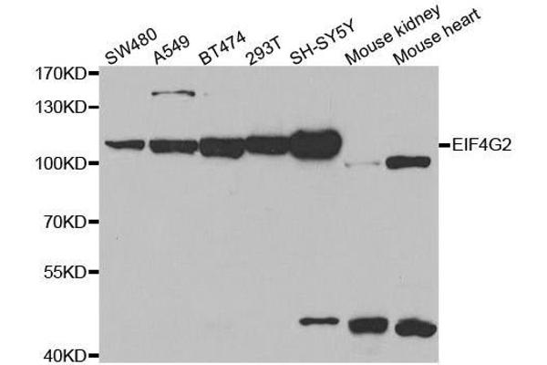 EIF4G2 antibody  (AA 750-850)