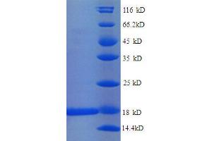 SDS-PAGE (SDS) image for 30S Ribosomal Protein S11 (AA 2-129), (full length) protein (His tag) (ABIN1046320)