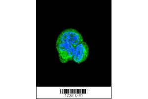 Image no. 5 for anti-Aspartoacylase (ASPA) antibody (ABIN2157794)