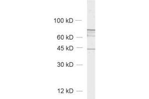 Image no. 1 for anti-Solute Carrier Family 6 (Neurotransmitter Transporter, Noradrenalin), Member 2 (SLC6A2) (AA 189-204) antibody (ABIN1742519)