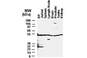 Image no. 3 for anti-Bifunctional Apoptosis Regulator (BFAR) (AA 1-139) antibody (ABIN957165)