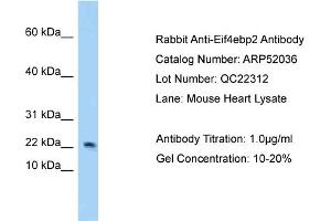 Image no. 1 for anti-Eukaryotic Translation Initiation Factor 4E Binding Protein 2 (EIF4EBP2) (N-Term) antibody (ABIN2784743)