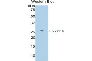 Podocin antibody  (AA 138-371)
