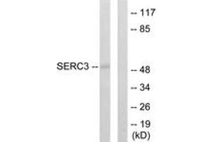 Image no. 2 for anti-Serine Incorporator 3 (SERINC3) (AA 361-410) antibody (ABIN1533872)