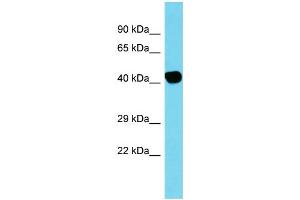 Image no. 1 for anti-Actin, beta-Like 2 (ACTBL2) (C-Term) antibody (ABIN2791406)