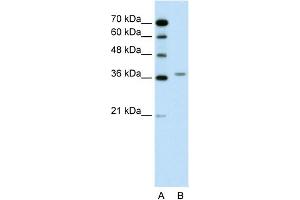 Image no. 1 for anti-Aminolevulinate Dehydratase (ALAD) (N-Term) antibody (ABIN2776921)