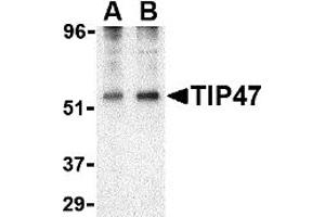 Western Blotting (WB) image for anti-Perilipin 3 (PLIN3) (N-Term) antibody (ABIN1031617)