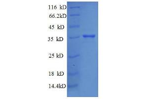 SDS-PAGE (SDS) image for 30S Ribosomal Protein S18 (RpsR) (AA 2-75), (full length) protein (GST tag) (ABIN1046328)