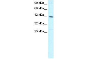 Image no. 2 for anti-Forkhead Box F2 (FOXF2) (N-Term) antibody (ABIN2777418)