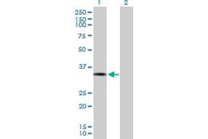 Image no. 1 for anti-FOS-Like Antigen 1 (FOSL1) (AA 1-271) antibody (ABIN521743)