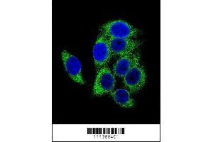 Image no. 2 for anti-Tuberous Sclerosis 2 (TSC2) (pSer1387) antibody (ABIN1881949)