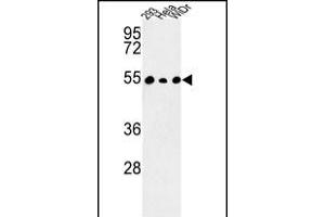 PPP1R36 抗体  (N-Term)