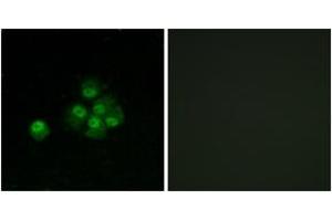 Image no. 3 for anti-Insulin Receptor Substrate 1 (IRS1) (AA 603-652), (pSer636) antibody (ABIN1531878)
