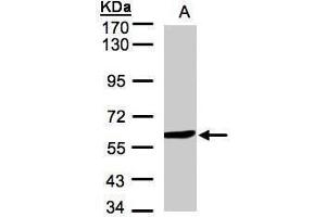 Image no. 3 for anti-Monoamine Oxidase B (MAOB) (Center) antibody (ABIN2856231)