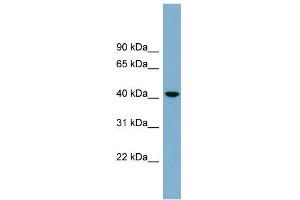 Image no. 2 for anti-UDP-Gal:betaGlcNAc beta 1,4- Galactosyltransferase, Polypeptide 2 (B4GALT2) (Middle Region) antibody (ABIN2781897)