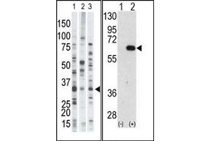 Image no. 1 for anti-Autocrine Motility Factor Receptor (AMFR) (N-Term) antibody (ABIN357584)
