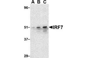 Image no. 2 for anti-Interferon Regulatory Factor 7 (IRF7) (C-Term) antibody (ABIN500058)