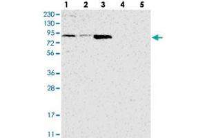 Image no. 2 for anti-ATPase Family, AAA Domain Containing 2B (ATAD2B) antibody (ABIN5573068)