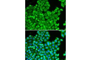 Image no. 2 for anti-Cysteine and Glycine-Rich Protein 1 (CSRP1) antibody (ABIN3021360)
