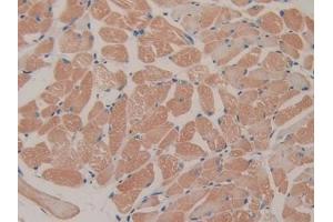 Image no. 3 for anti-Feline Sarcoma Oncogene (FES) (AA 510-770) antibody (ABIN5013541)