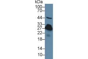 Image no. 2 for anti-C-Reactive Protein (CRP) (AA 20-230) antibody (ABIN1077879)