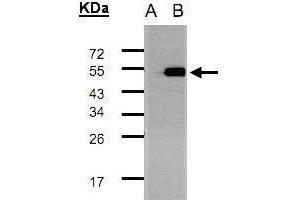 WB Image Western Blot analysis of TADA3L expression in transfected 293T cell line by TADA3L polyclonal antibody.
