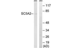 Image no. 1 for anti-Solute Carrier Family 5 (Sodium/glucose Cotransporter), Member 2 (SLC5A2) (AA 101-150) antibody (ABIN1535380)