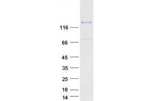 Image no. 1 for DNA Helicase B (HELB) protein (Myc-DYKDDDDK Tag) (ABIN2722585)