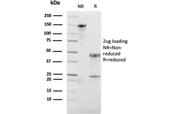 anti-Tumor Necrosis Factor Receptor Superfamily, Member 4 (TNFRSF4) (AA 59-205) antibody