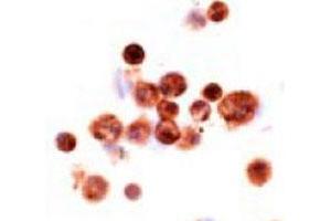 Image no. 1 for anti-Macrophage Scavenger Receptor 1 (MSR1) antibody (ABIN533480)