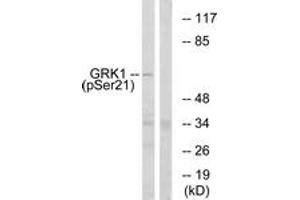 Western blot analysis of extracts from COS7 cells treated with TNF 20ng/ml 5', using GRK1 (Phospho-Ser21) Antibody.