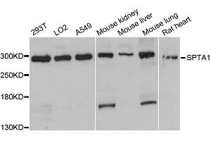 Image no. 1 for anti-Spectrin alpha 1, Erythrocytic (SPTA1) antibody (ABIN6148401)