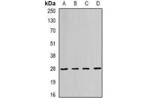 Image no. 2 for anti-RAB11A, Member RAS Oncogene Family (RAB11A) (full length) antibody (ABIN6004832)